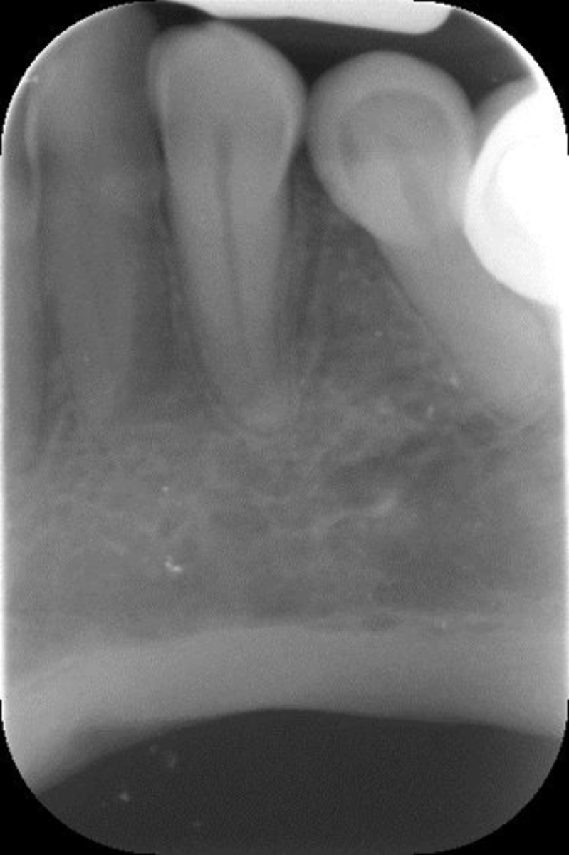 <p>What is this error?</p>