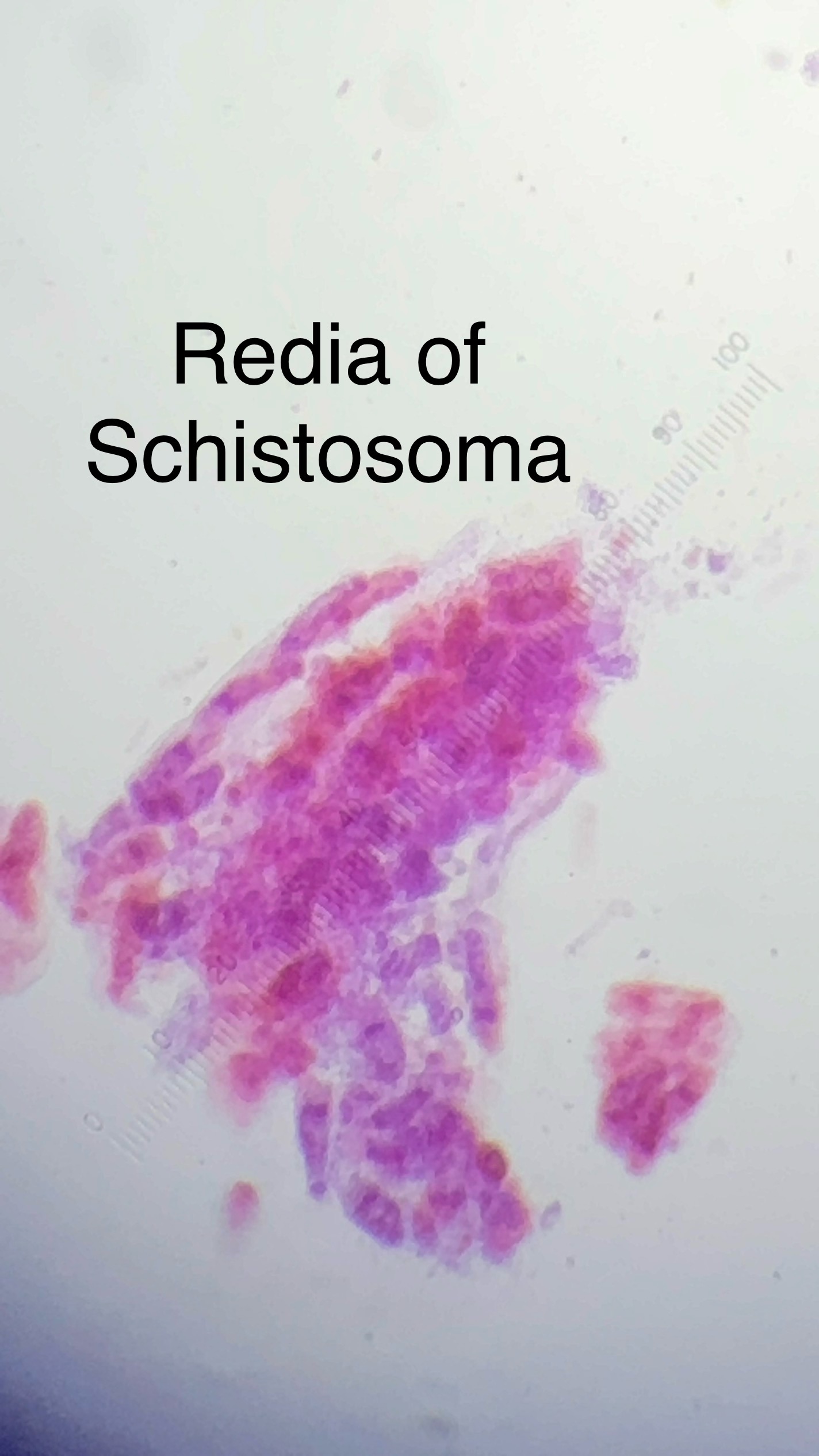 <p>Schistosoma haematobium (blood fluke)</p>