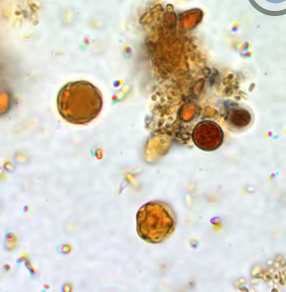 <p>Professor: Dr. Glena Fe A. Yapchulay-Alcabasa</p>