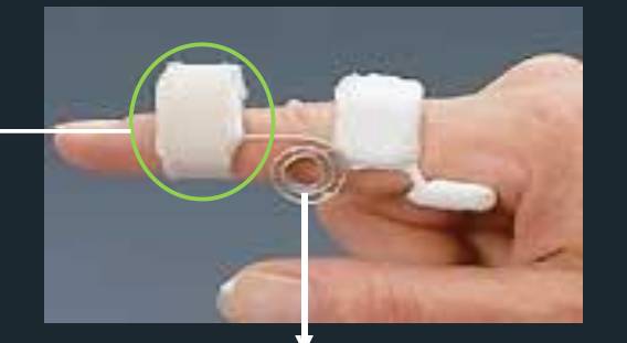 <p>Capener Splint - Parts</p>