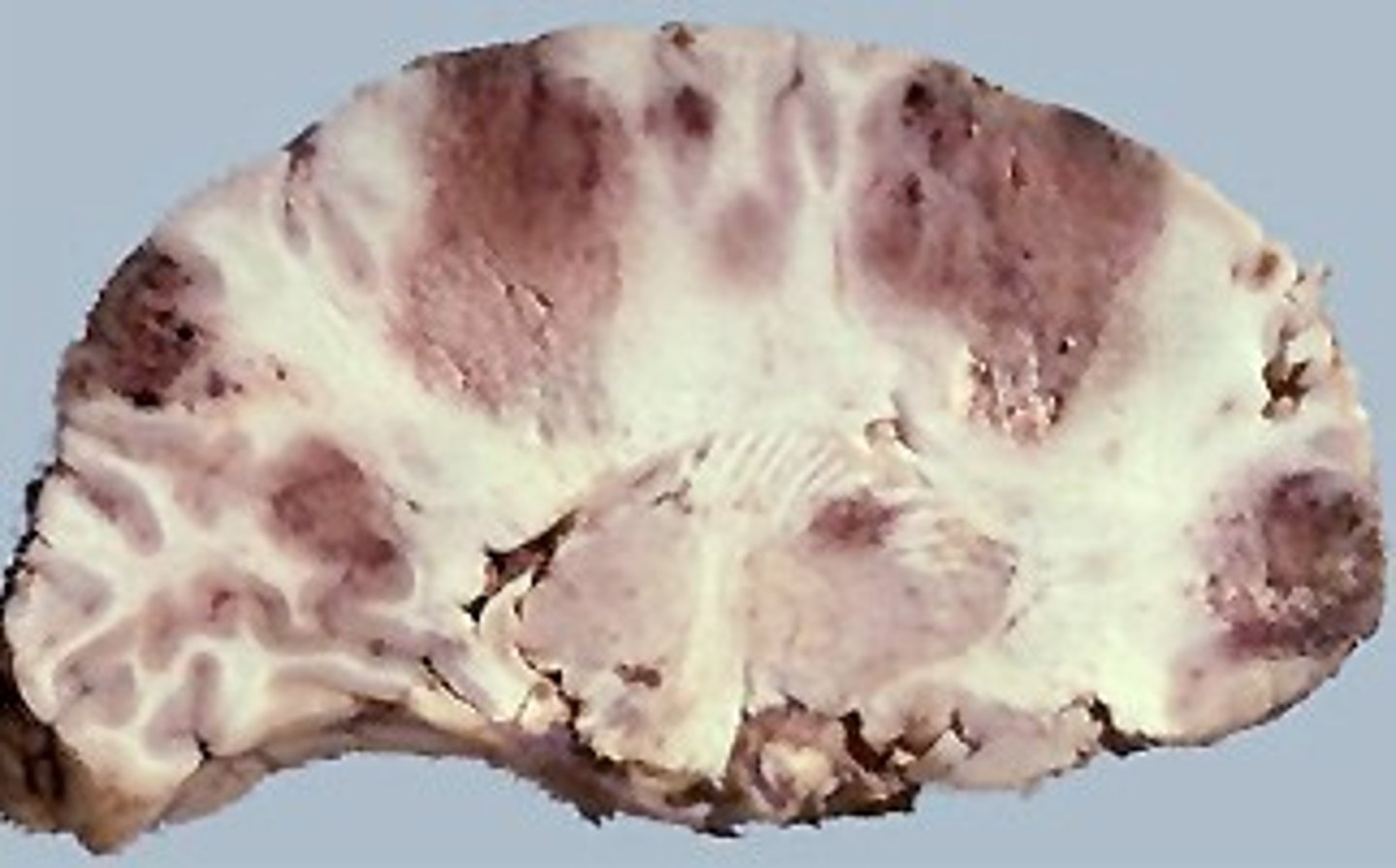 <p>The eukaryotic cell does not have a cell wall so you can't treat it with antibiotics</p>