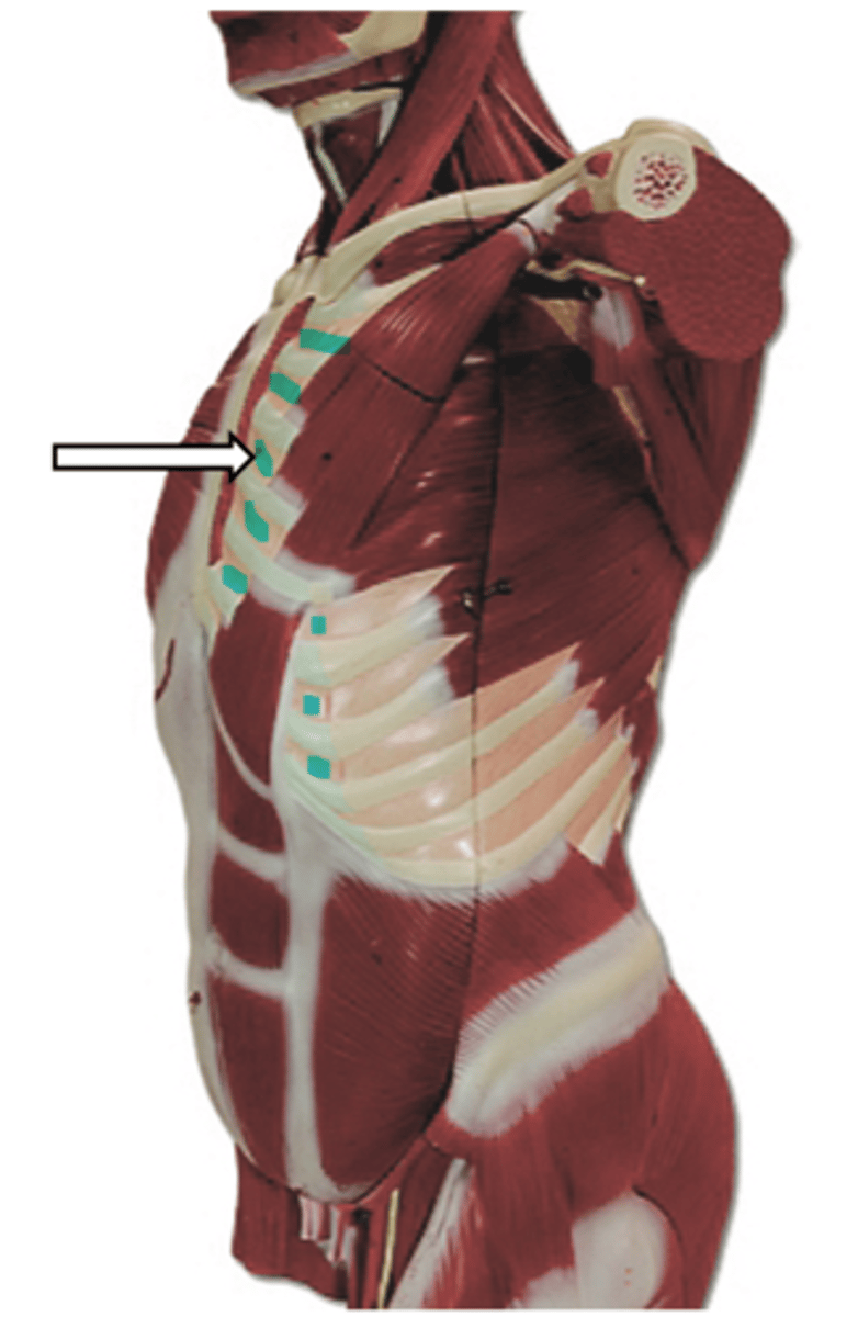 <p>name the muscle</p>