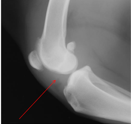 <p>What is the arrow pointing to? </p>