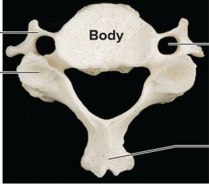<p>What kind of vertebre is this?</p>