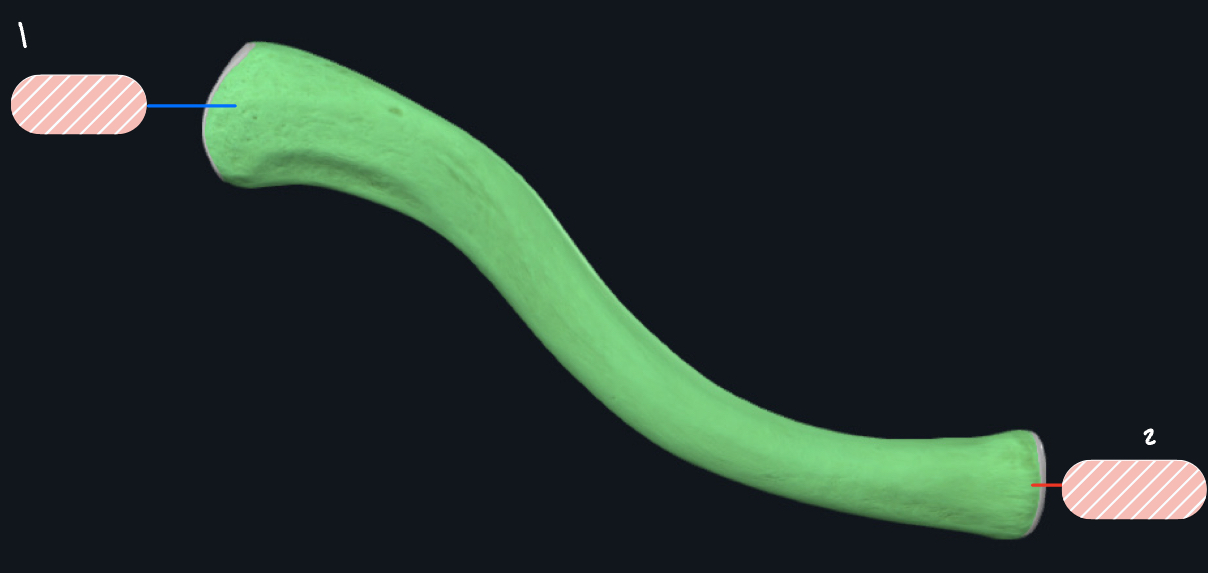 <p>What bone is this?</p>