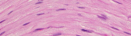 <p>is this a normal peripheral nerve?</p>