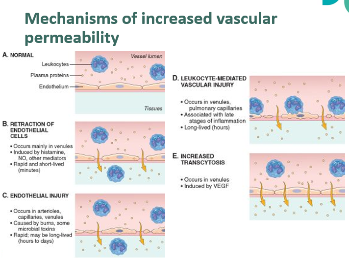 <ul><li><p><span><span>Increased vascular permeability is due to contraction of endothelial cells</span></span></p><ul><li><p><span><span>Occurs mainly in venules</span></span></p></li><li><p><span><span>Often short-lived</span></span></p></li></ul></li><li><p><span><span>Another mechanism is endothelial damage</span></span></p><ul><li><p><span><span>Can be caused by trauma, burns, microbial damage</span></span></p></li><li><p><span><span>Can also be caused by leukocyte-mediated damage to the endothelium (often longer-lived)</span></span></p></li></ul></li><li><p><span><span>Increased transcytosis can also result in leakage of plasma components into the interstitial space</span></span></p></li></ul><p></p>