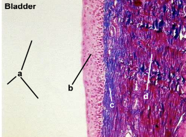 <p>a. Identify Space</p><p>b. Identify Epithelium</p><p>c. Identify blue stained cell layer </p><p>d. Identify red stained cell layer</p>