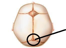 junction of lambdoid and sagittal sutures (closes by 2 months)
