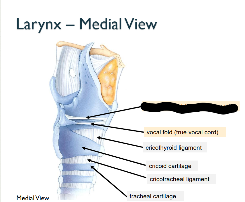 <p>What structure is this, within the<strong> Larynx - MEDIAL</strong></p>