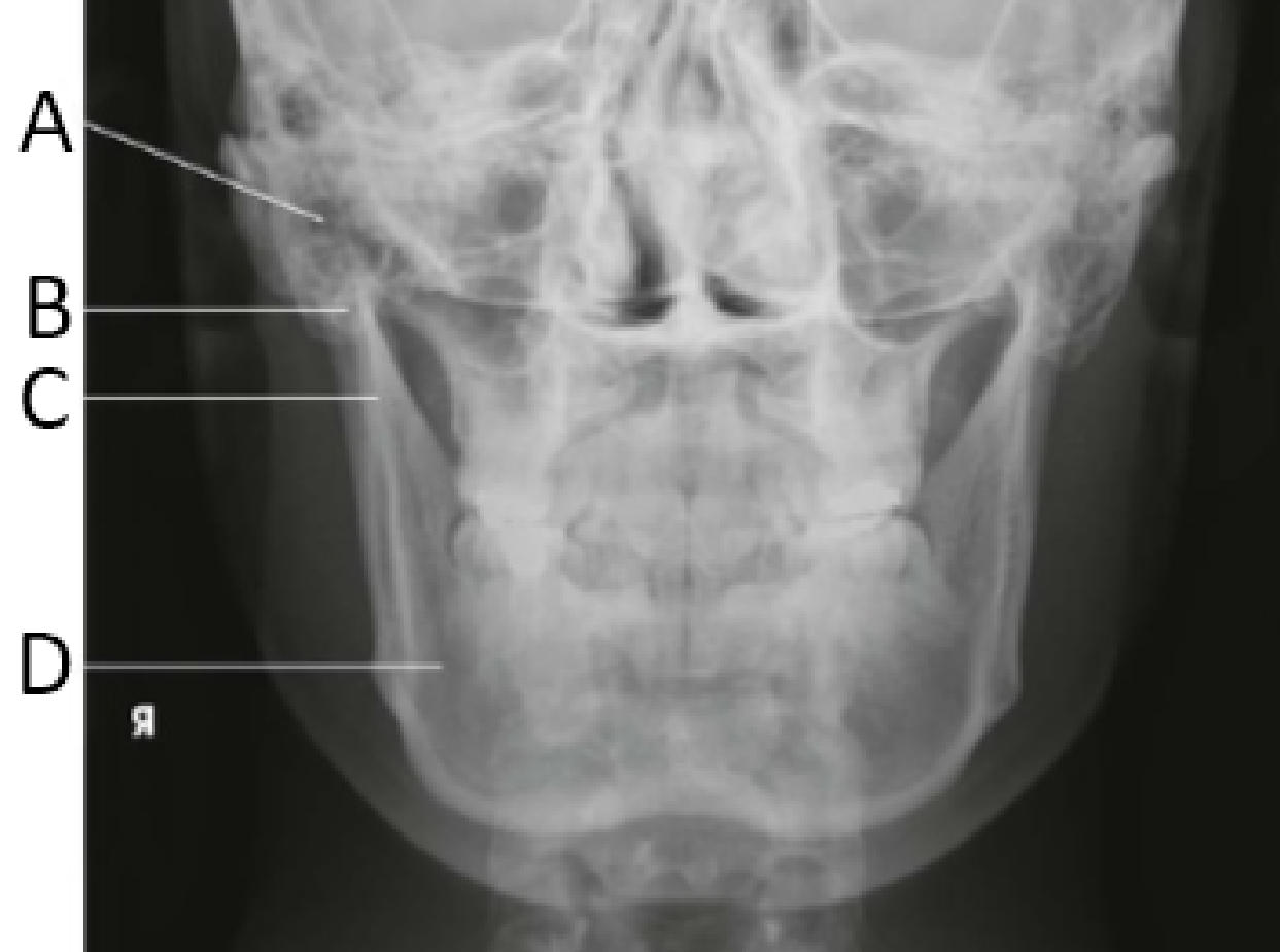 <p><strong>Identify letter B</strong></p>