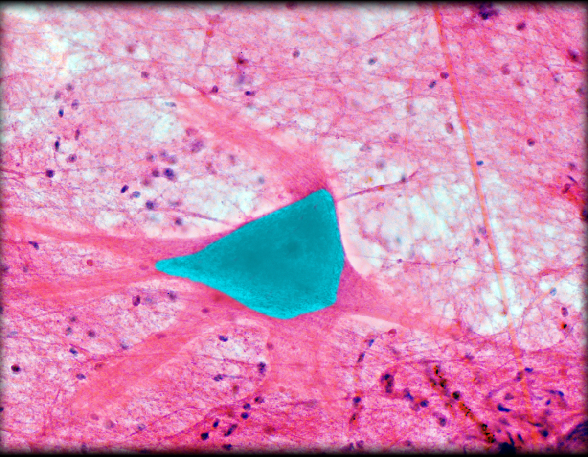 <h4 collapsed="false" seolevelmigrated="true"><strong>Location:</strong></h4><ul><li><p>Central nervous system</p></li><li><p>Ganglia of autonomic nervous system</p></li></ul><h4 collapsed="false" seolevelmigrated="true"><strong>Description:</strong></h4><ul><li><p>Cell body of neuron</p></li><li><p>Two types of processes: dendrites and axons</p></li><li><p>Contains Nissl bodies</p></li></ul><h4 collapsed="false" seolevelmigrated="true"><strong>Function:</strong></h4><ul><li><p>Nucleus and other cytoplasmic organelles support neuron structure and function</p></li></ul><h4 collapsed="false" seolevelmigrated="true"><strong>Comment:</strong></h4><ul><li><p>Axons convey efferent nerve impulses (i.e., away from soma)</p></li><li><p>Dendrites convey afferent nerve impulses (i.e., towards soma)</p></li><li><p>Nissl bodies (dark-staining region) represent aggregates of rough endoplasmic reticulum</p></li></ul>
