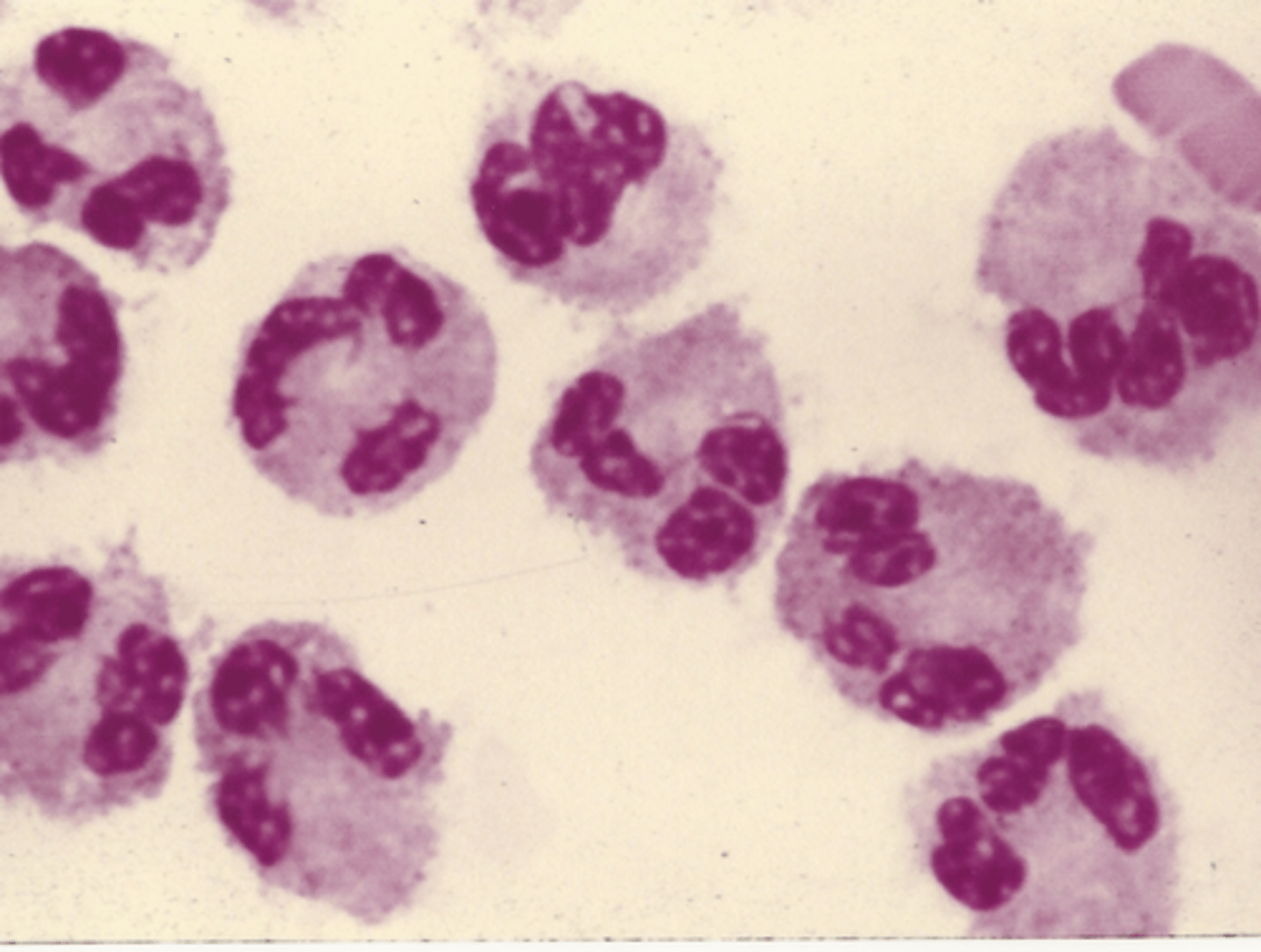 <p>Identify the cells in this body fluid</p>