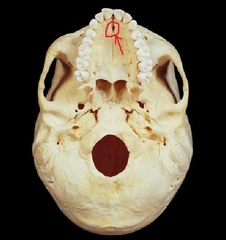 Name this foramen.