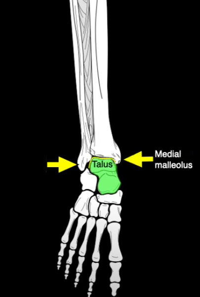<p>What section of the fibula is this?</p>