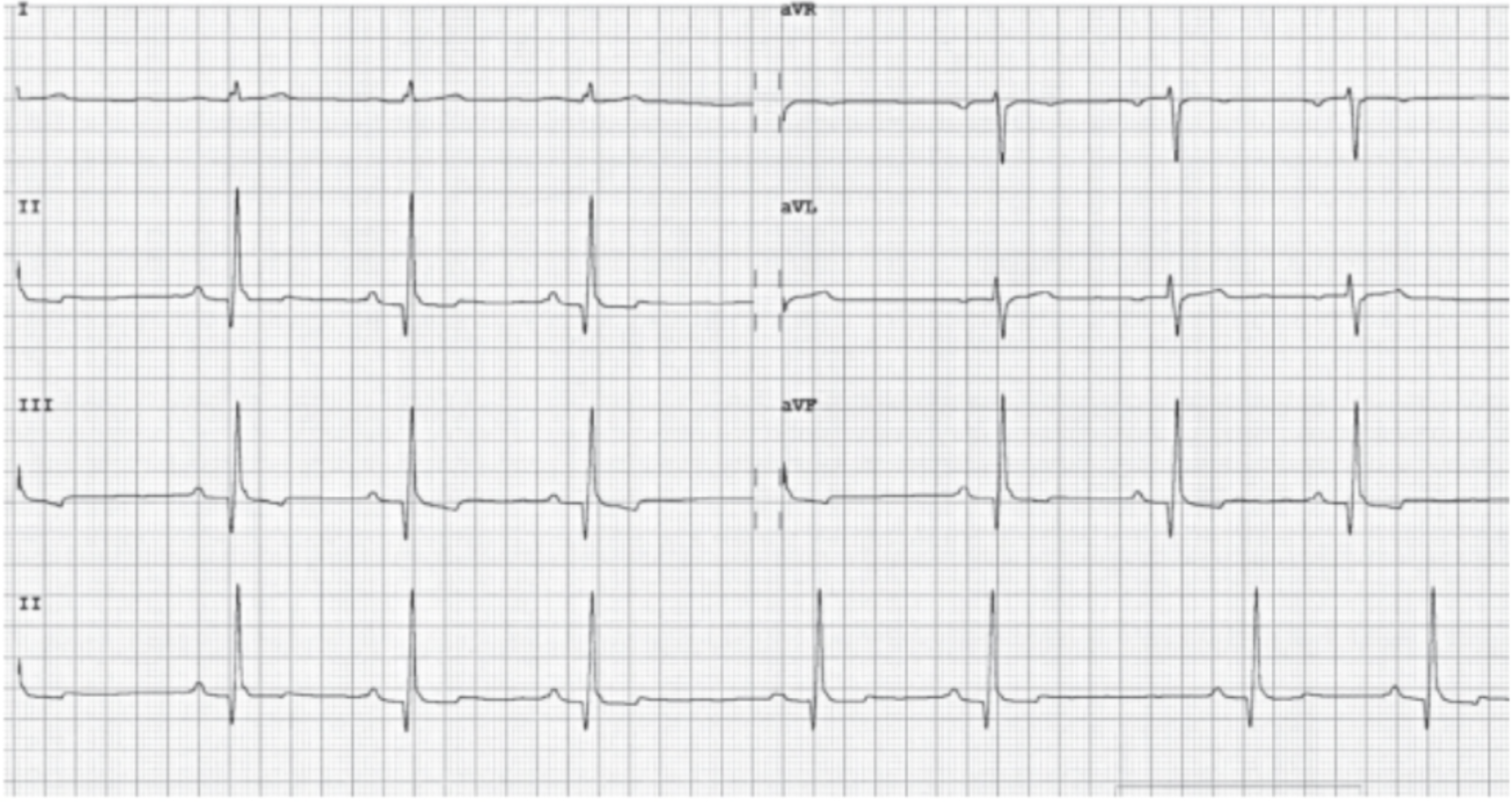 <p><span>Name, reading summary, and significance of this rhythm:</span></p>