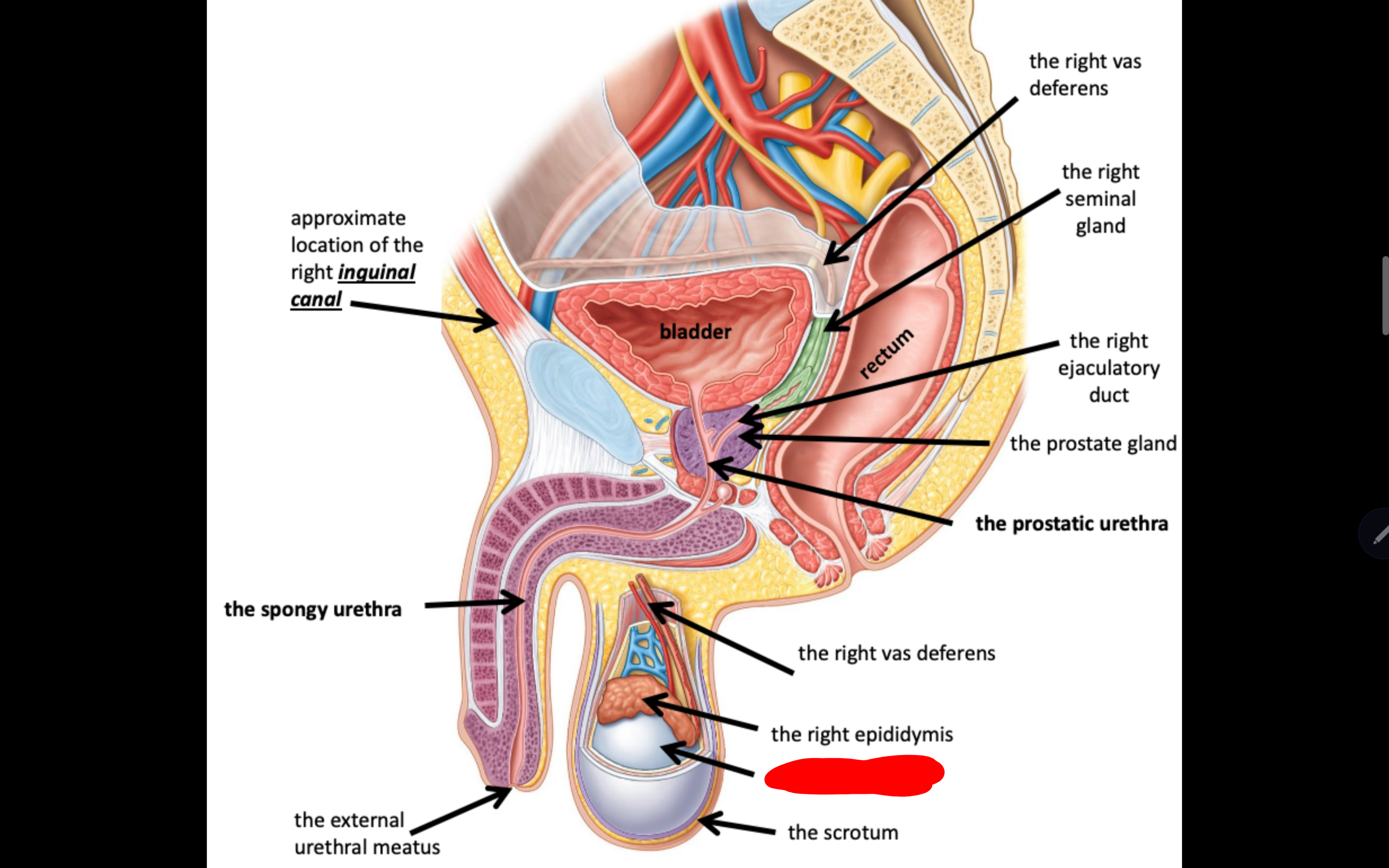 <p>Name the structure in red</p>