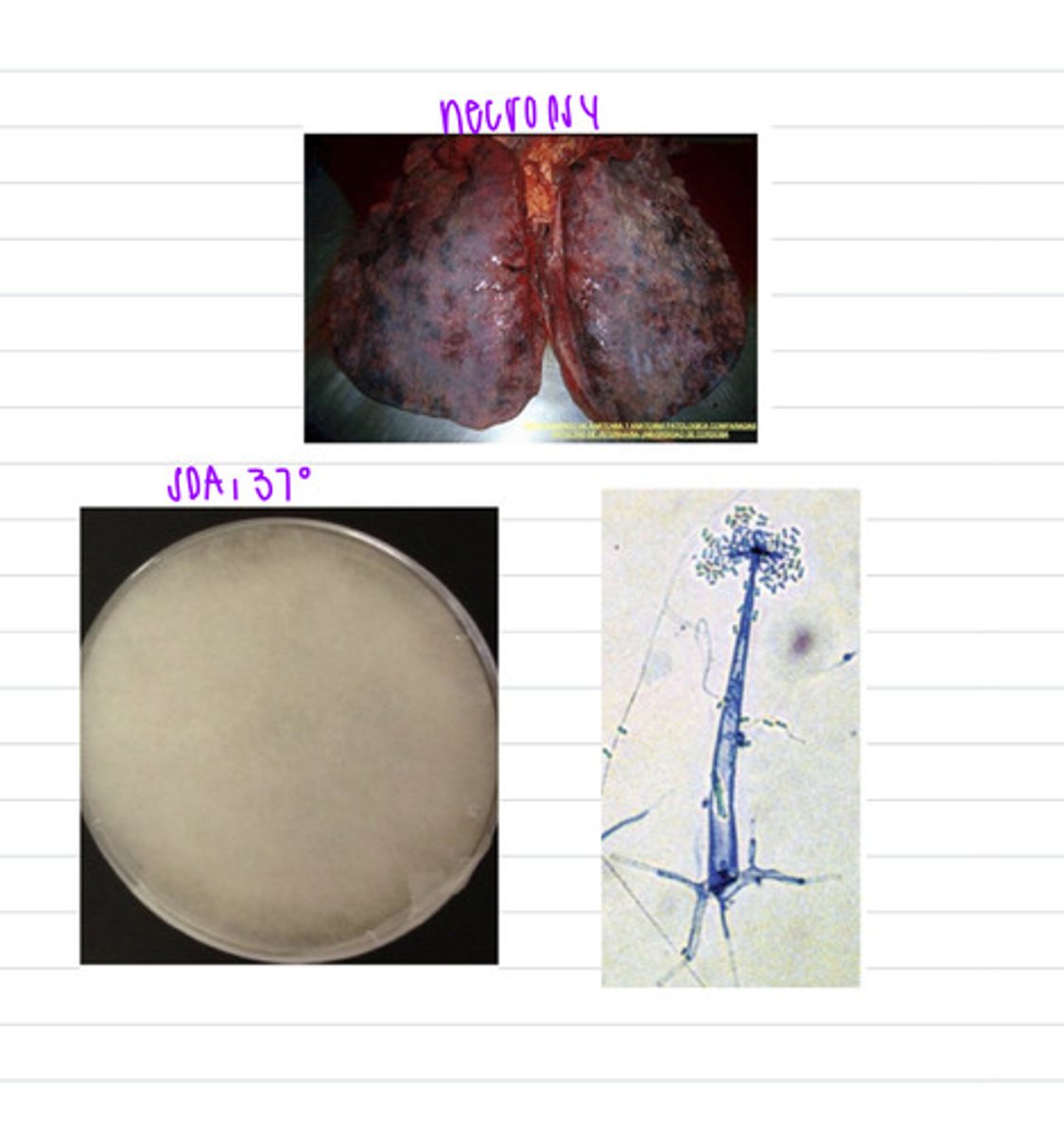 <p>a dog came into the vet with signs of pneumonia- coughing, fever, dyspnea,etc. it unfortunately dies, but we do a necropsy and find these lung lesions. we grow samples in SDA at 37 degrees and these are the results.</p><p>what samples should we take?</p><p>what is this diagnosis?</p>