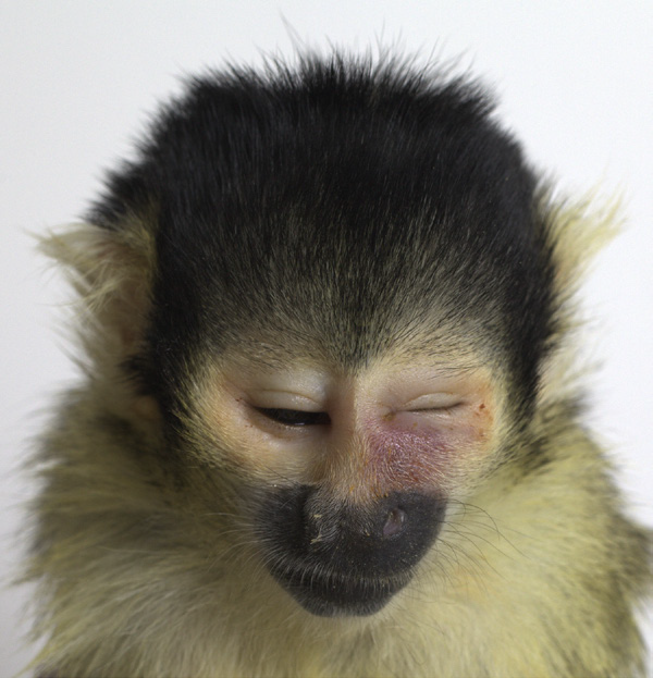 <p>Common noninfectious cause of this photo?</p>