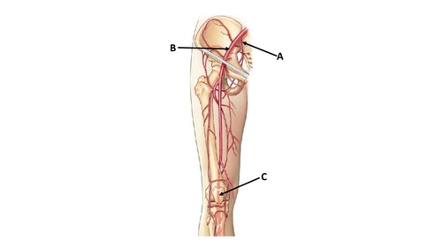 <p>Name the blood vessel labeled 'A'.</p>