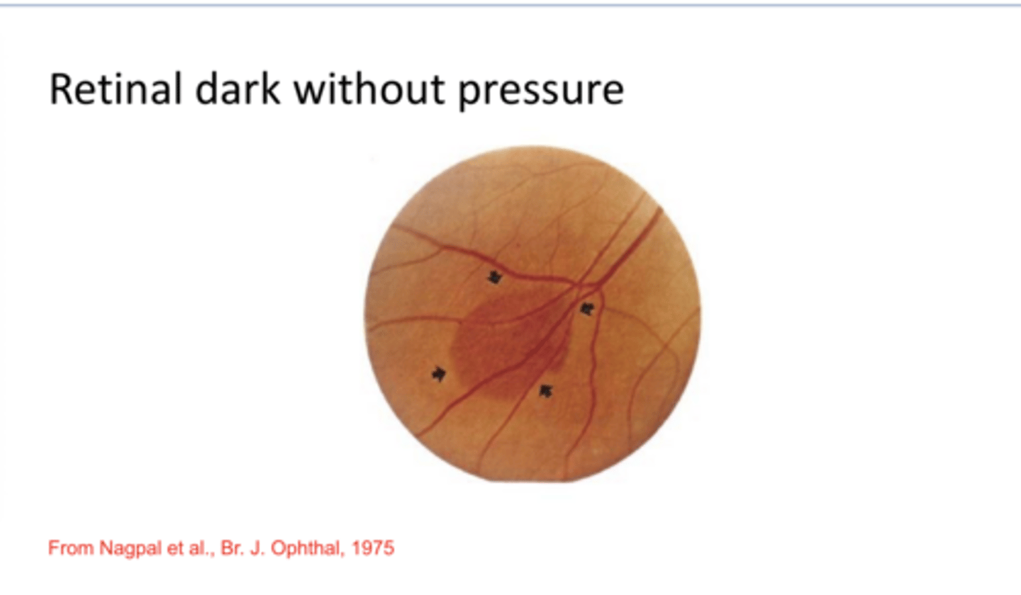 <p>Retinal Dark w/o Pressure (Pic)</p>