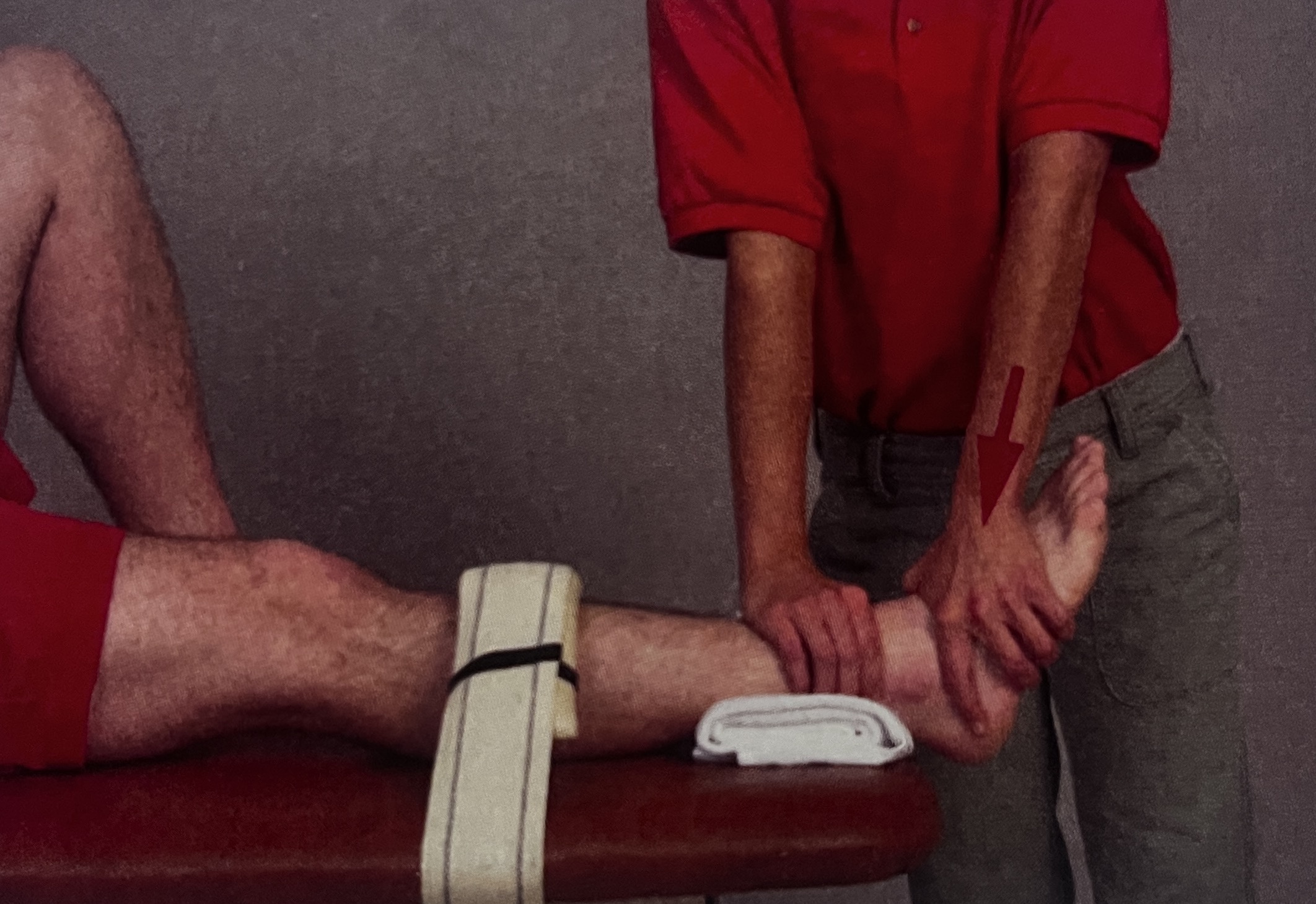 <p>What joint mob is this?</p>