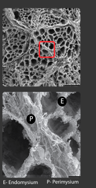 <p>intramuscular connective tissue that wraps around the fascicles </p>