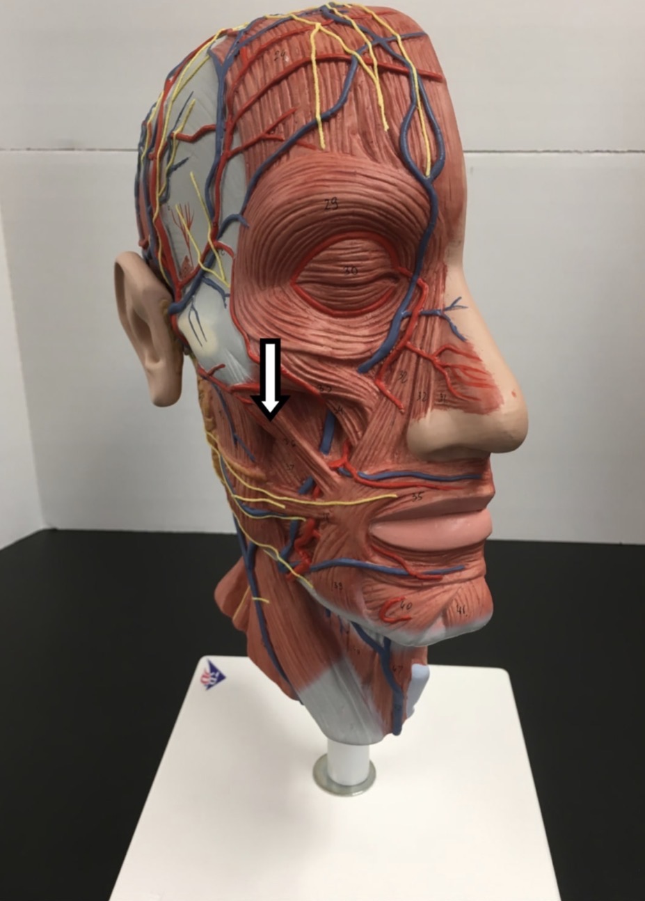 <p><span>Name the muscle labeled with the white arrow below:</span></p>