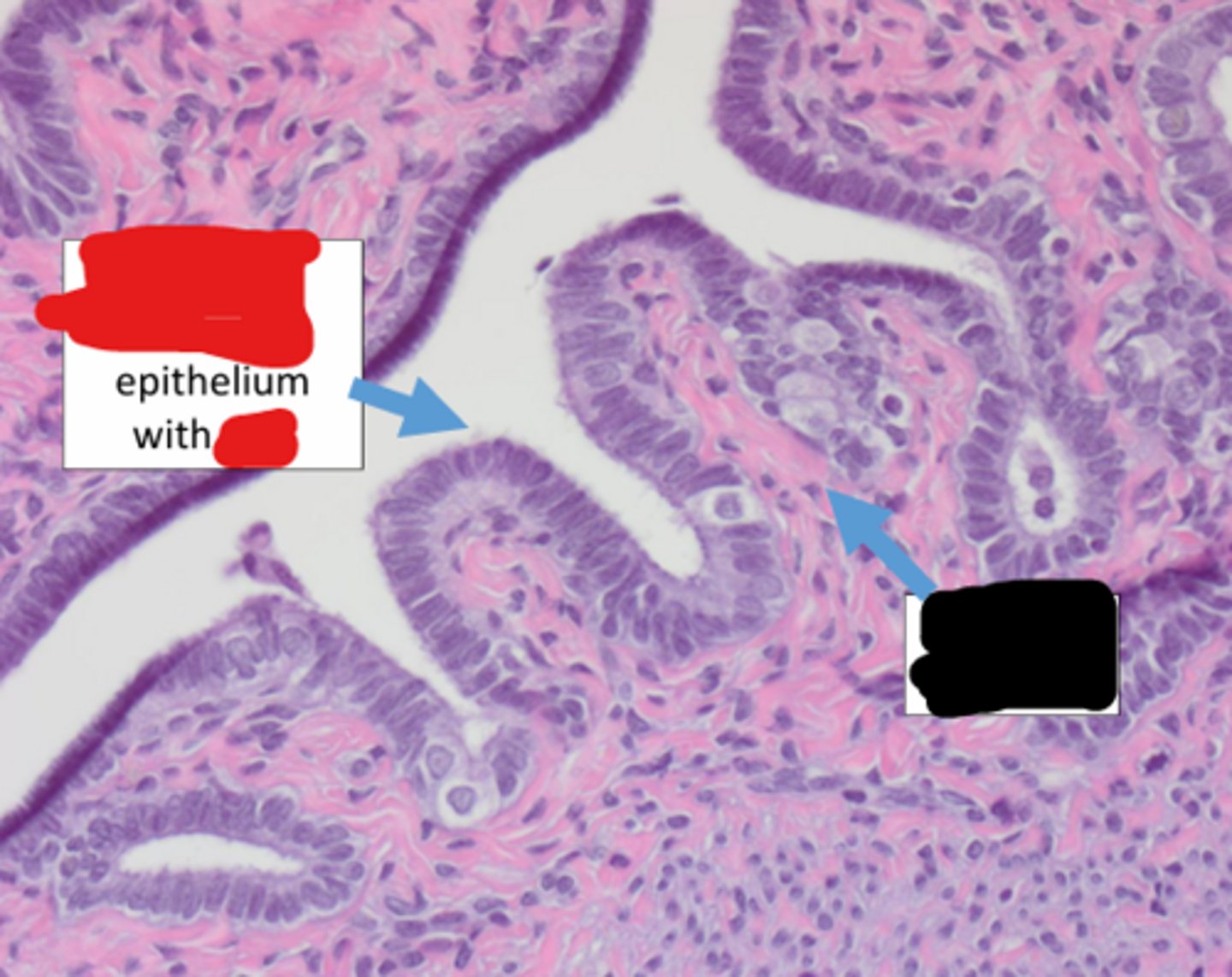 <p>this is the oviduct. identify black</p>