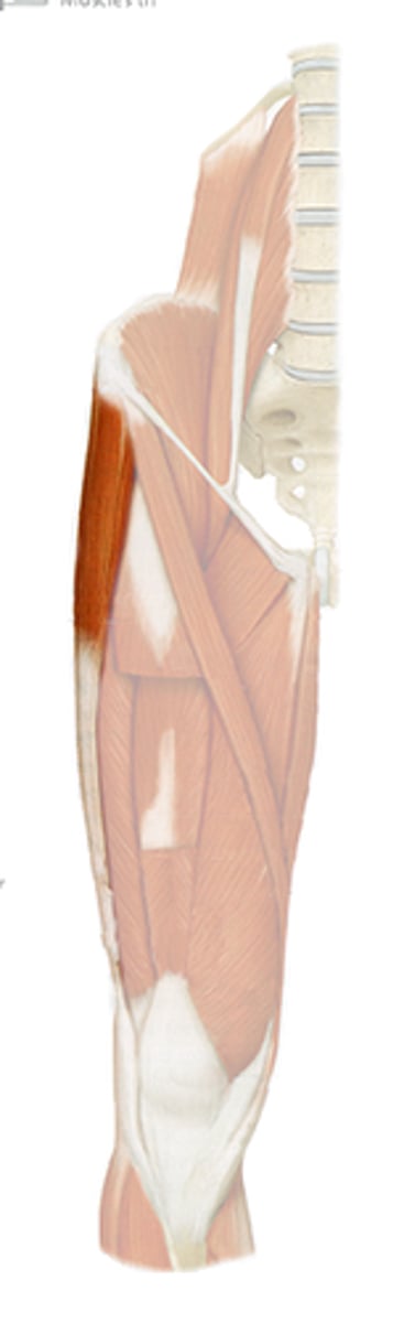 <p>what thigh muscle is this, and what is its action</p>