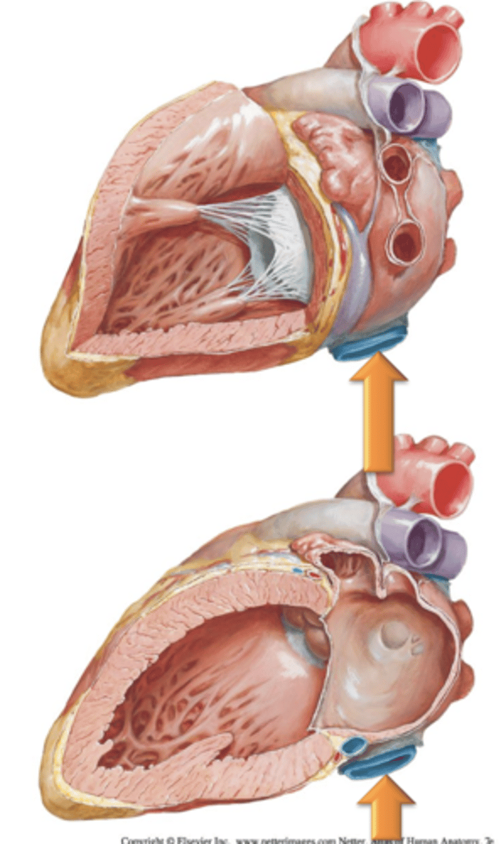 <p>Major vessel that receives blood from the lower limbs, pelvis and abdomen and enters the right atrium of the heart inferiorly.</p>