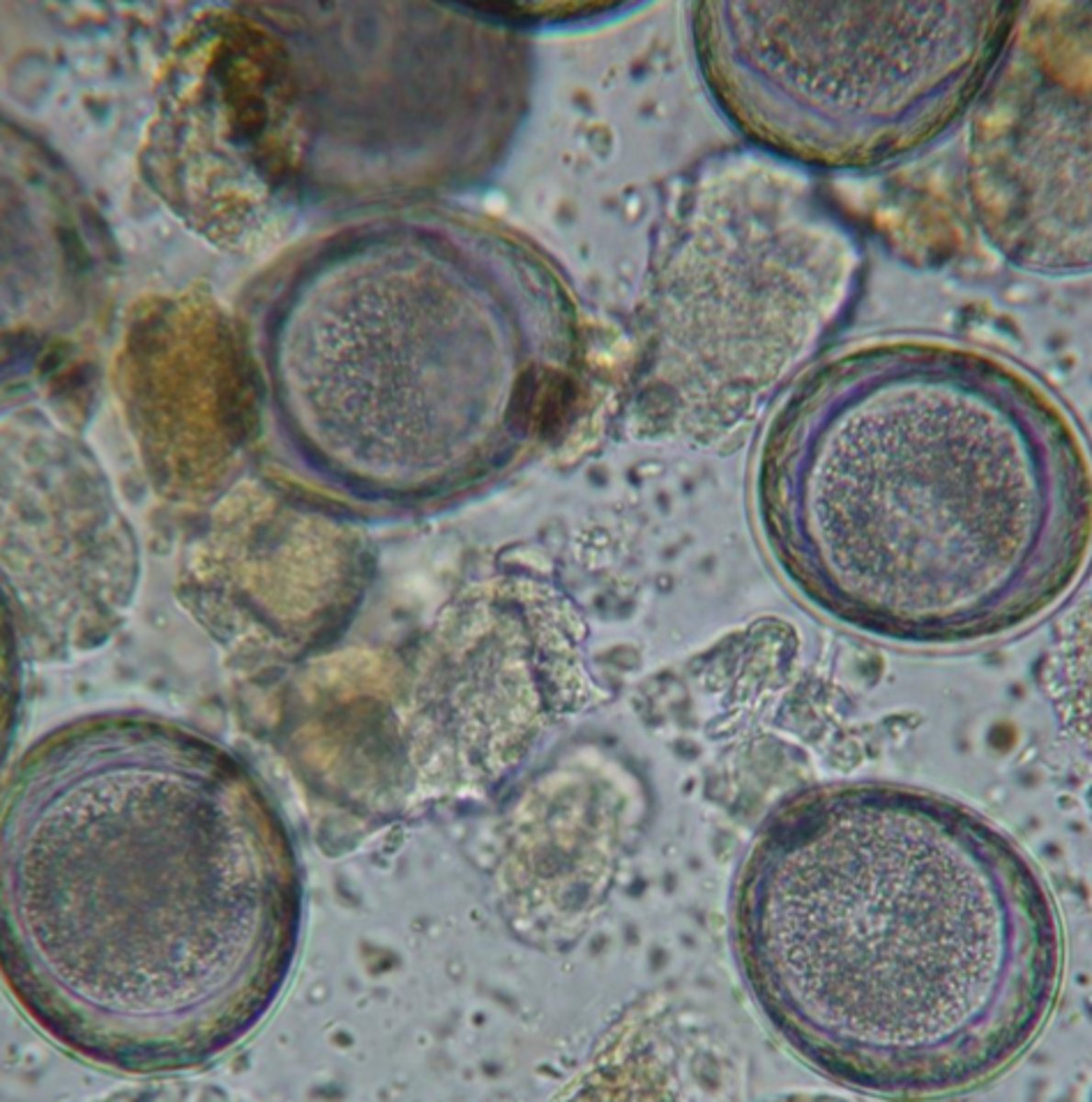<p>what type of worm in scientific name is this?</p>
