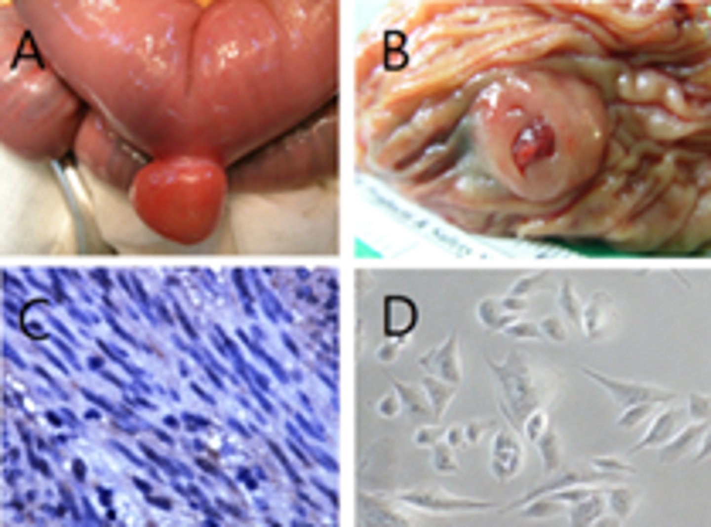 <p>1. EUS with fine-needle aspiration (FNA) biopsy</p><p>2.) CT Abdomen/Pelvis with contrast</p><p>3.) Since the tumor is greater then 2cm it should be surgically removed</p>
