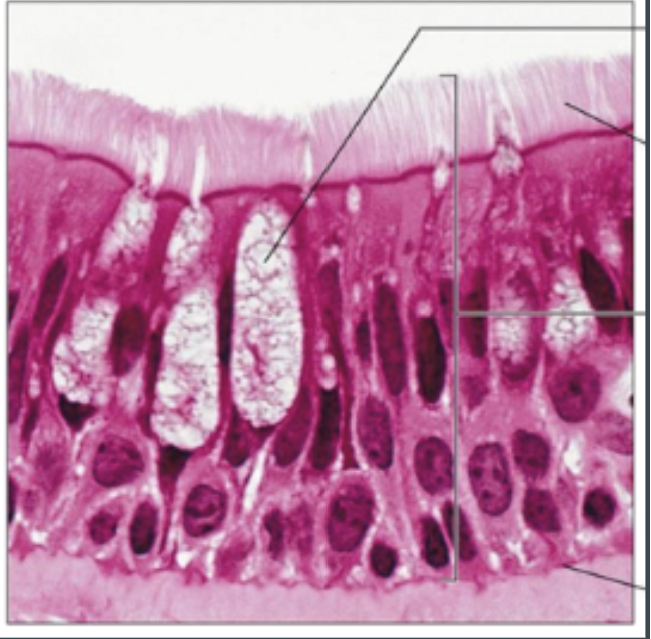 <p>(epithellial) different height rectangular shapes with nuclei that are NOT lined up</p>