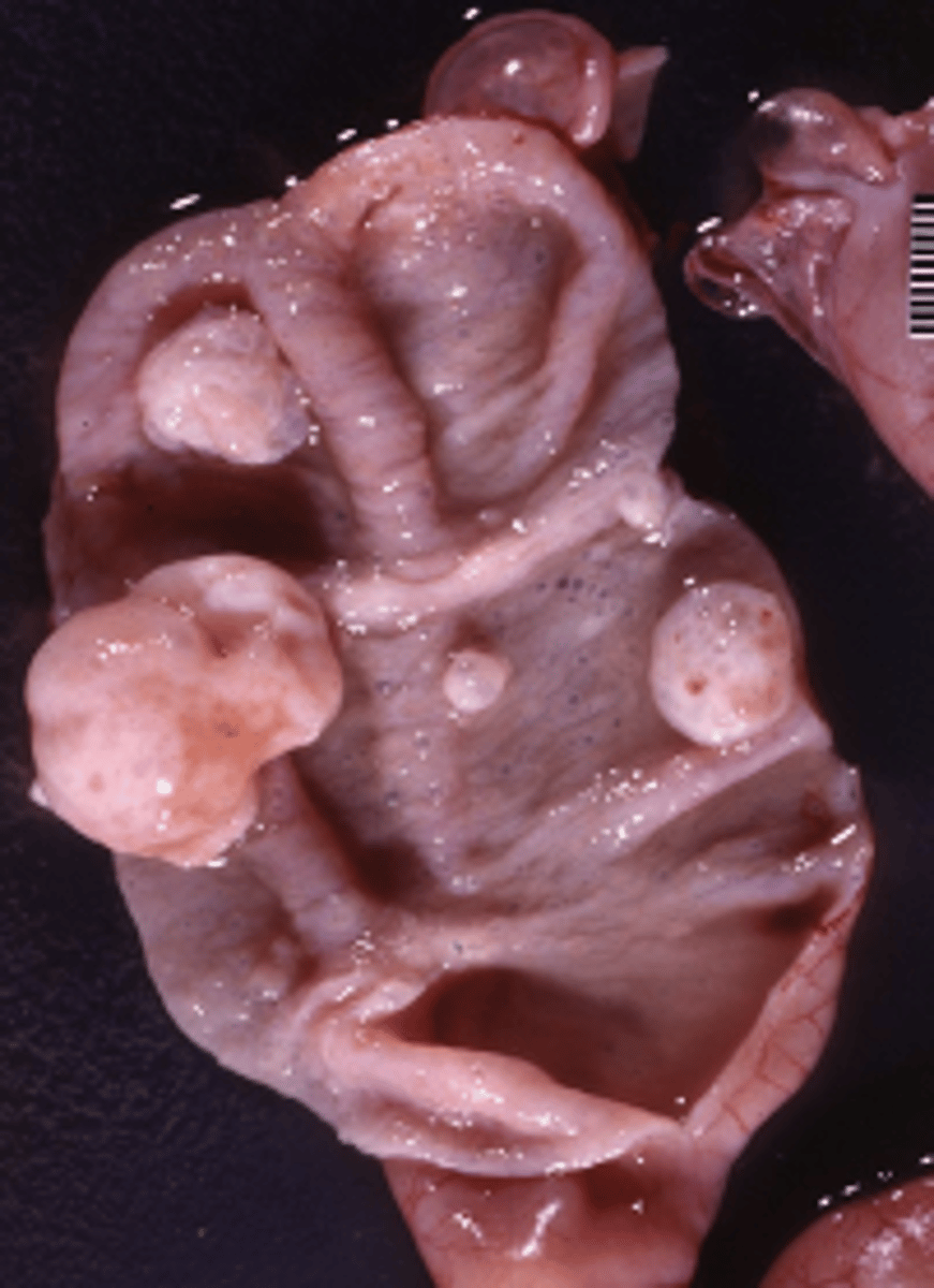 <p>Classify this lesion:</p><p>Cyst</p><p>Abscess</p><p>Polyp</p><p>Ulcer</p>