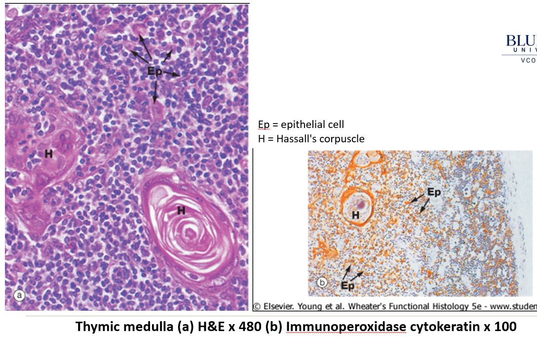 <p><strong>Layered structures in the thymus</strong> made of <strong>degenerating epithelial cells</strong>. They help in <strong>T cell maturation and clonal selection</strong>, ensuring only functional immune cells survive.</p>