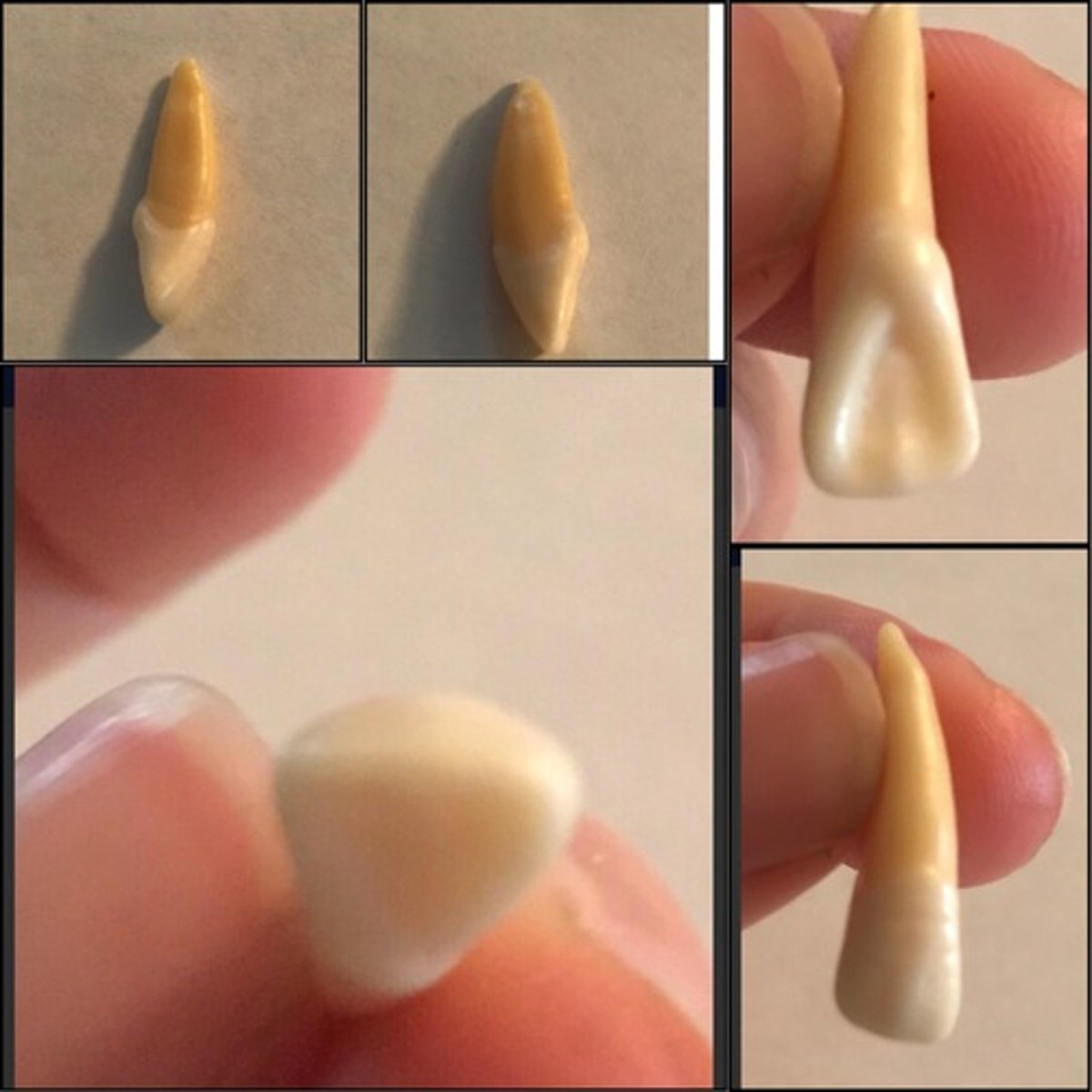 <p>What tooth is this ?</p>