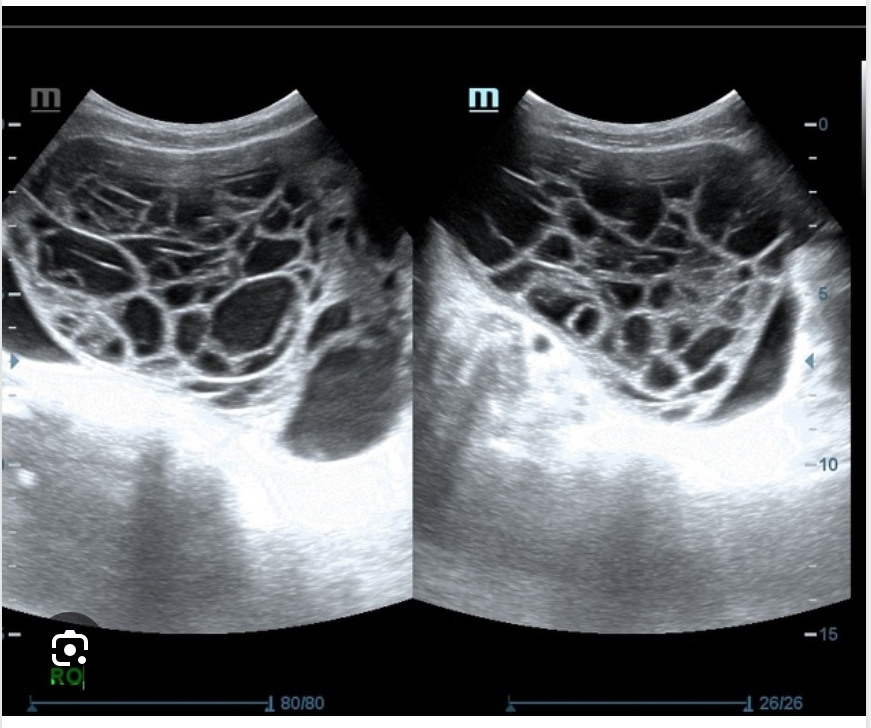 <p>Epithelial</p>