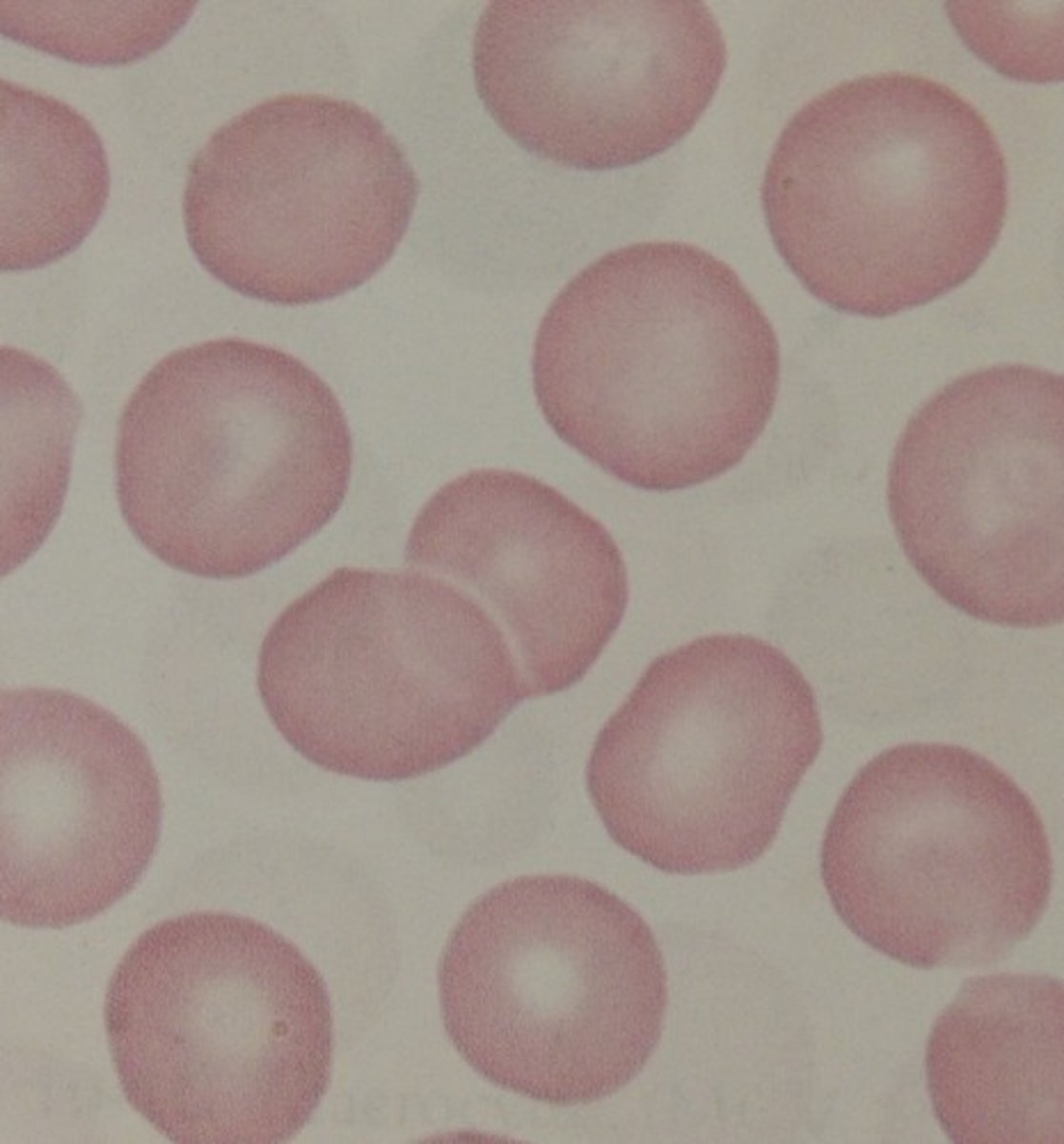 <p>normal color (1/3 central pallor and 2/3 red part ) </p>