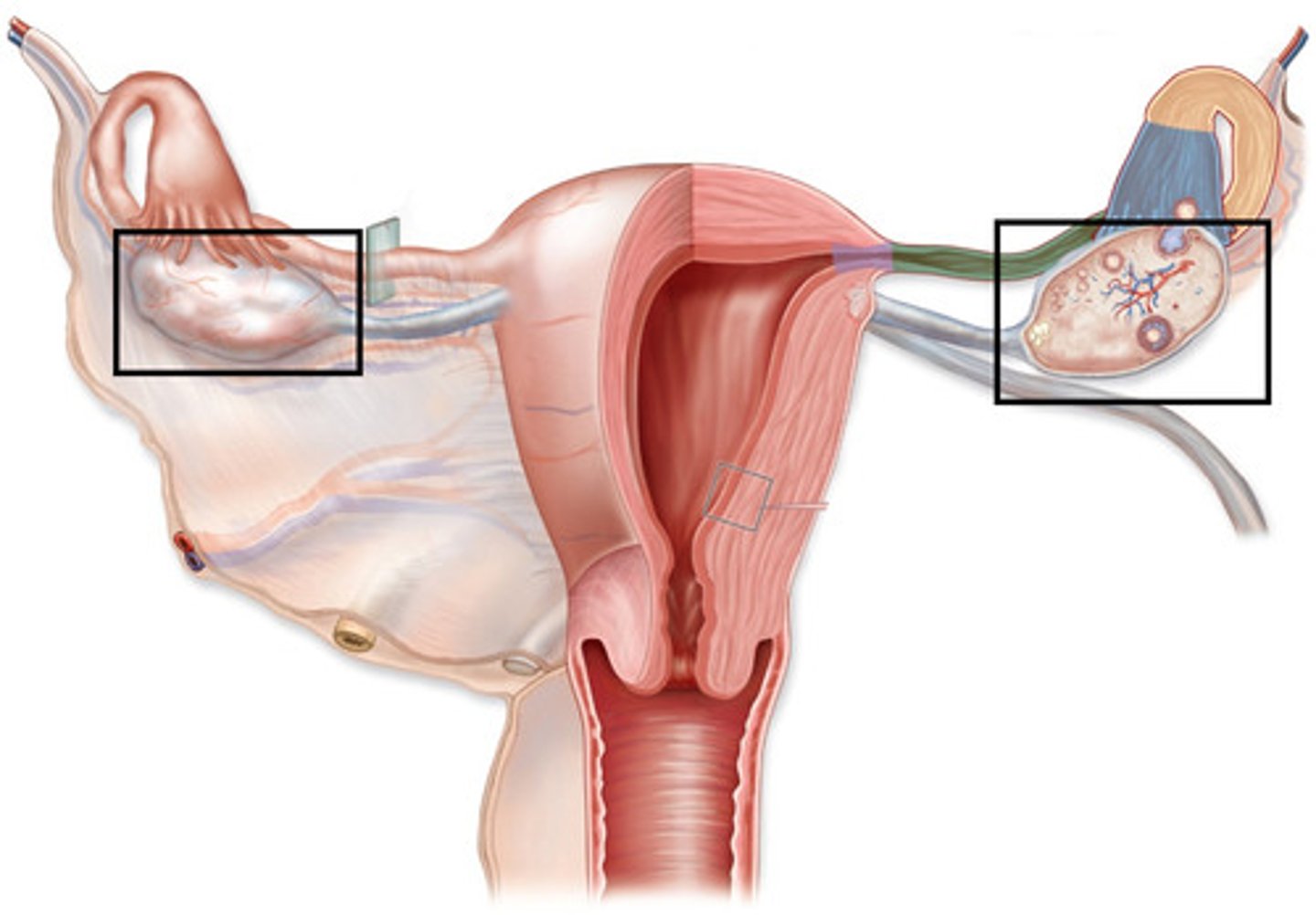 <p>-paired organs on each side of the uterus held in place by several ligaments</p><p>--> suspensory ligaments: anchor the ovary to the lateral body wall</p><p>--> ovarian ligament: attaches the ovary to the superior margin of the uterus; ovarian arteries, veins, and nerves enter the ovary through this ligament</p><p>--> broad ligament: supports the uterus</p><p>Visceral peritoneum</p><p>-covers the surface of the ovaries</p><p>Tunica albuginea</p><p>-outer capsule of the ovary that is divided internally into:</p><p>--> cortex: dense outer region that contains follicles</p><p>--> medulla: loose inner region that receives blood and lymphatic vessels and nerves</p><p>--> stroma: connective tissue of ovaries</p>