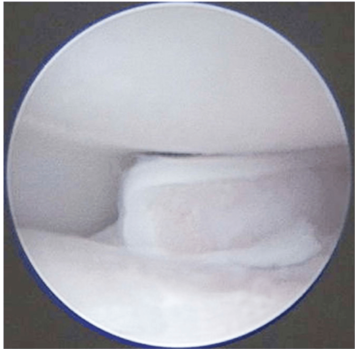 <p>what is the most valuable tool for dx. FCP</p>