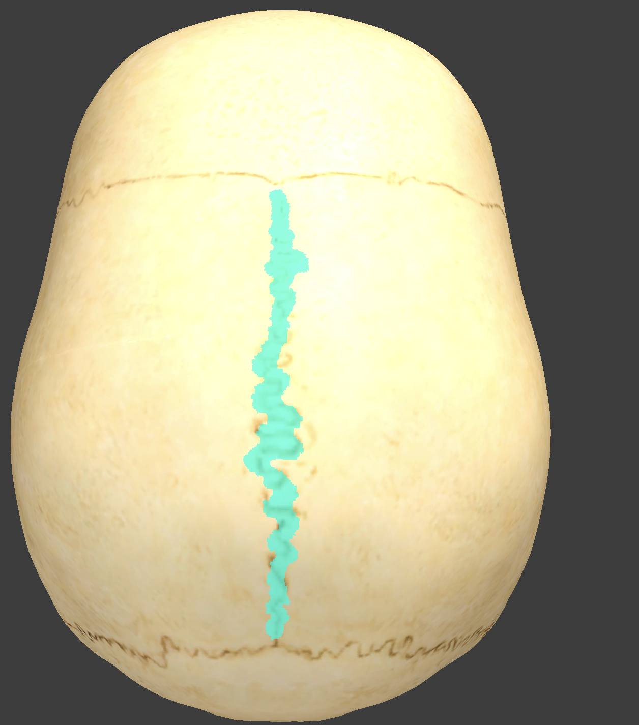 <p>what is this suture?</p>