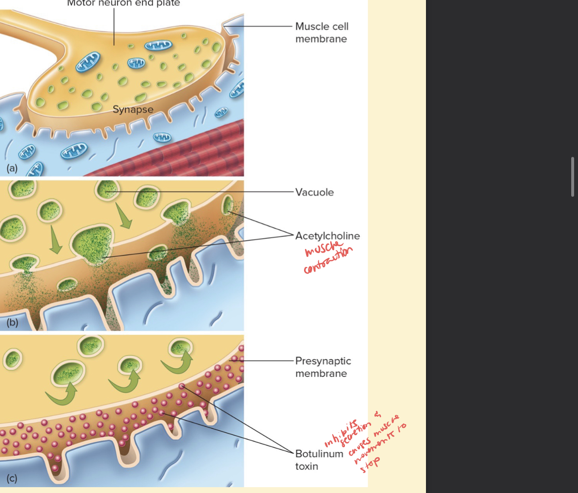 <p></p><ul><li><p>Intoxication associated with inadequate food preservation</p></li><li><p>Potent toxin, botulinum toxin is released and carried to neuromuscular junctions and blocks the release of acetylcholine, necessary for muscle contractions</p></li><li><p>Doubled or blurred vision</p></li><li><p>Difficulty swallowing</p></li><li><p>Neuromuscular symptoms</p></li></ul>