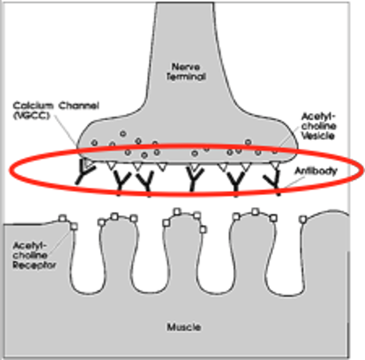 <p>body's immune system attacks calcium channels at the nerve endings, reducing neurotransmitter release and causing muscle weakness.</p>