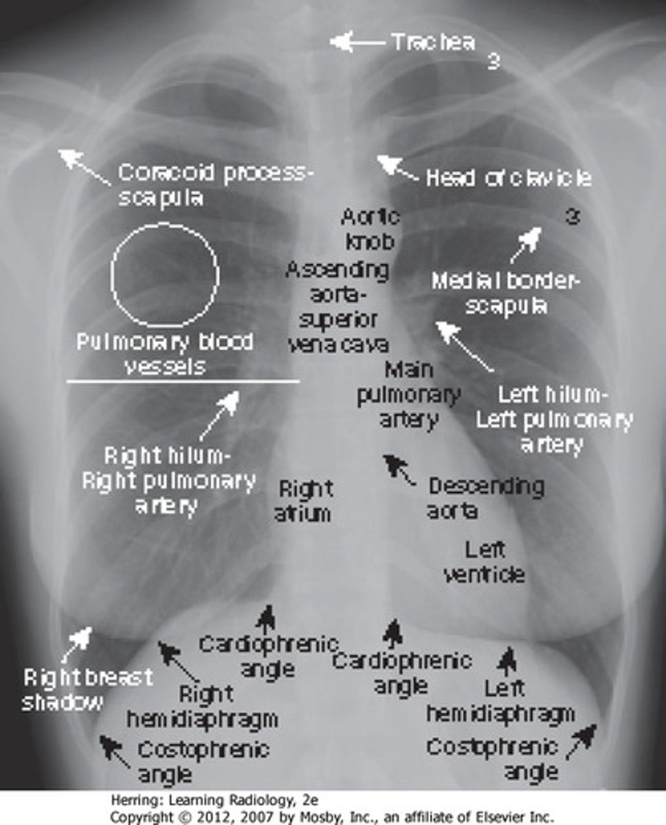 <p>Extreme outermost lower corner of each lung</p>