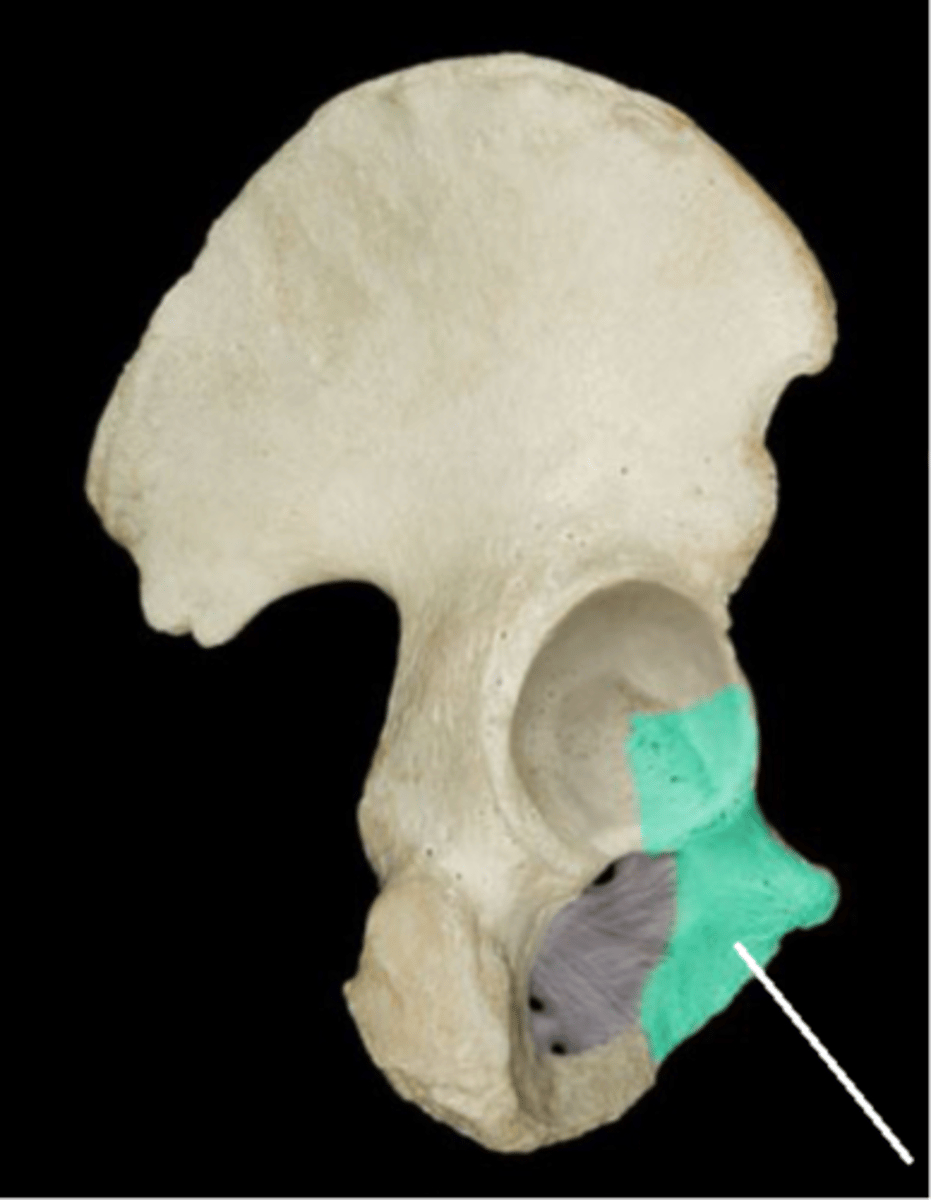 <p>Ischium</p>