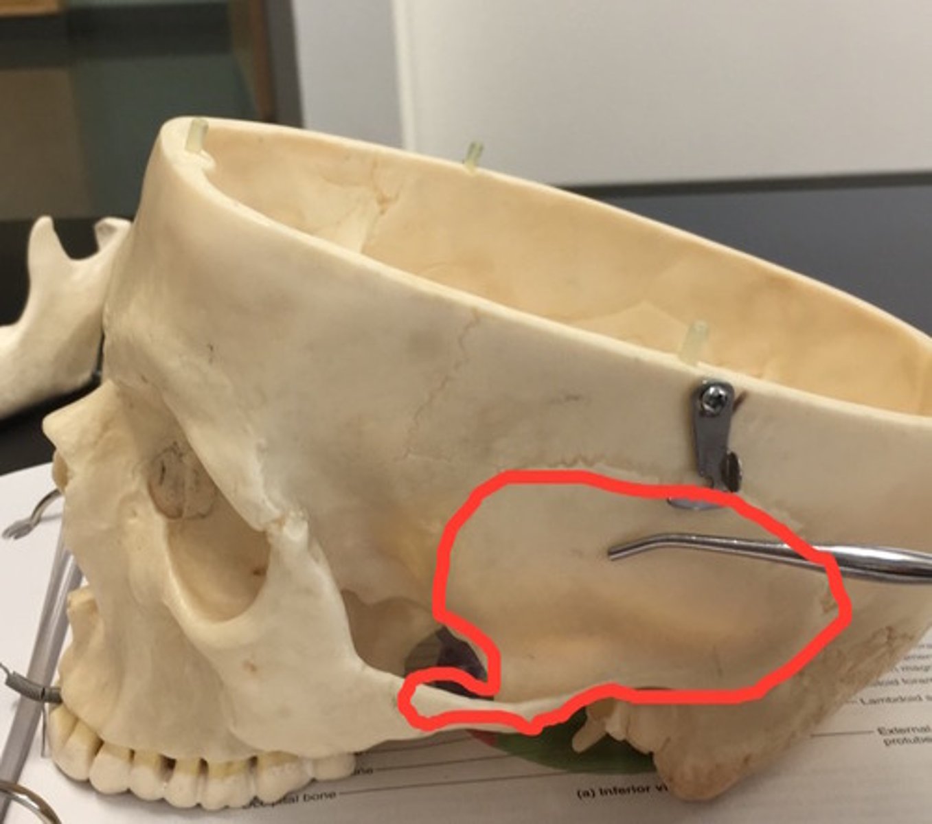 <p>contribute/s to the side/s and the base of the skull.</p>