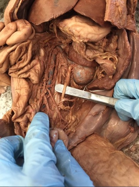 <p>What is indicated by the dissection tool in the image</p>
