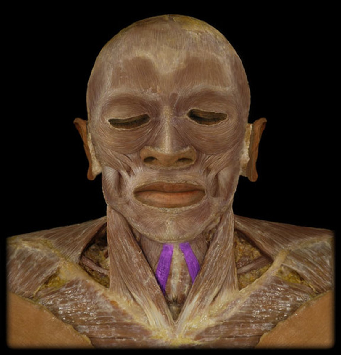 <p>located from the hyoid bone to the superior portion of the sternum</p><p>just lateral to the trachea</p><p>difficult to palpate specific muscle so know location</p>