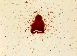 <p>What bloodstain pattern is this?</p>
